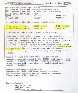 Morbo di Creutzfeldt-Jakob