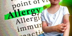 word "allergy" and girl with body rashes