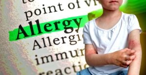 word "allergy" and girl with body rashes