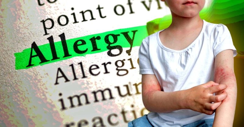 word "allergy" and girl with body rashes