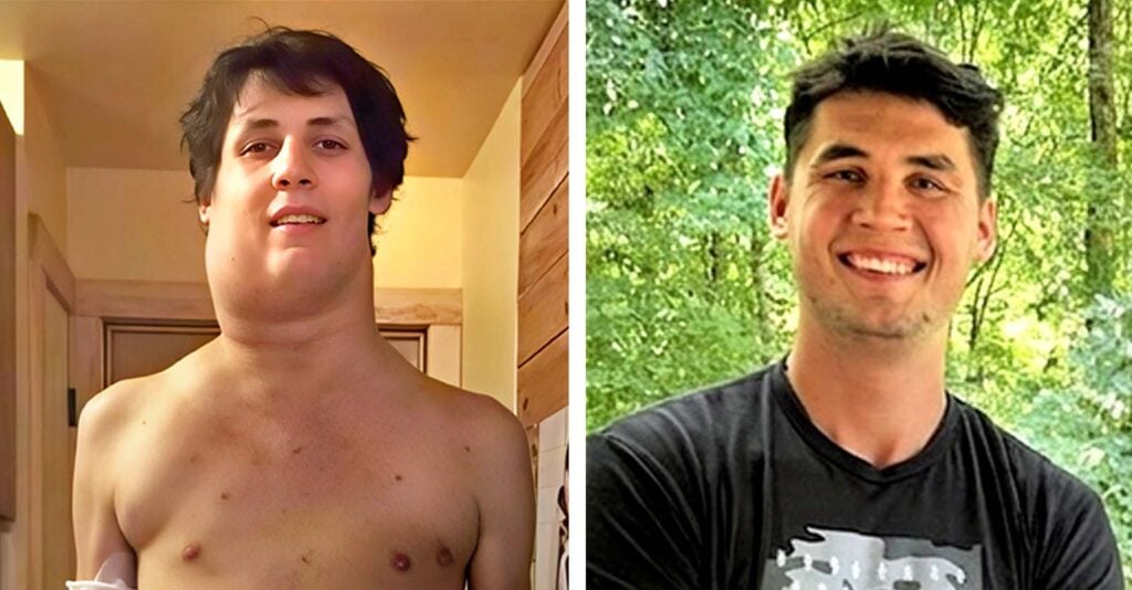 Tennessee teen glysophate