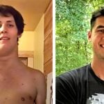 arden allison with tumor in neck on the left and current photo of him cancer free on the right