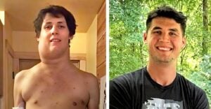 arden allison with tumor in neck on the left and current photo of him cancer free on the right