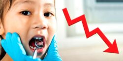 child at dentist and arrow going down