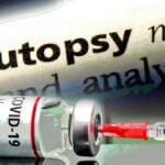 word "autopsy" and covid vaccine