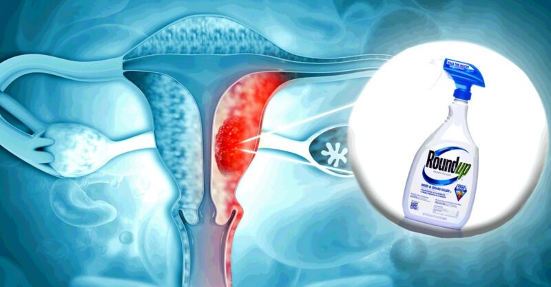uterus and glyphosate bottle