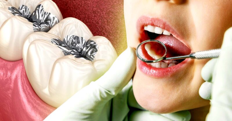 child at dentist and mercury filling