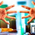 mmr vaccine and two hands