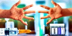 mmr vaccine and two hands