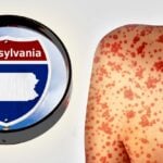 Pennsylvania sign and person with measles