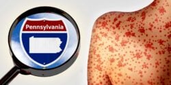 Pennsylvania sign and person with measles