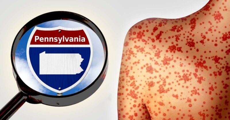 Pennsylvania sign and person with measles