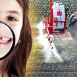 child showing missing teeth and tractor spraying pesticides