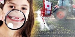 child showing missing teeth and tractor spraying pesticides