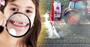 child showing missing teeth and tractor spraying pesticides