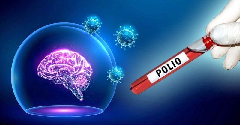 brain and word polio