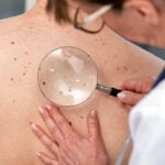 doctor checking skin