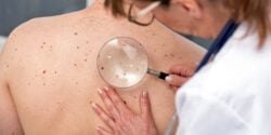 doctor checking skin