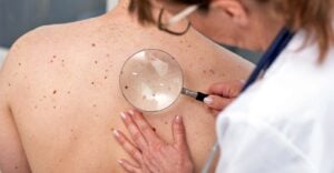 doctor checking skin