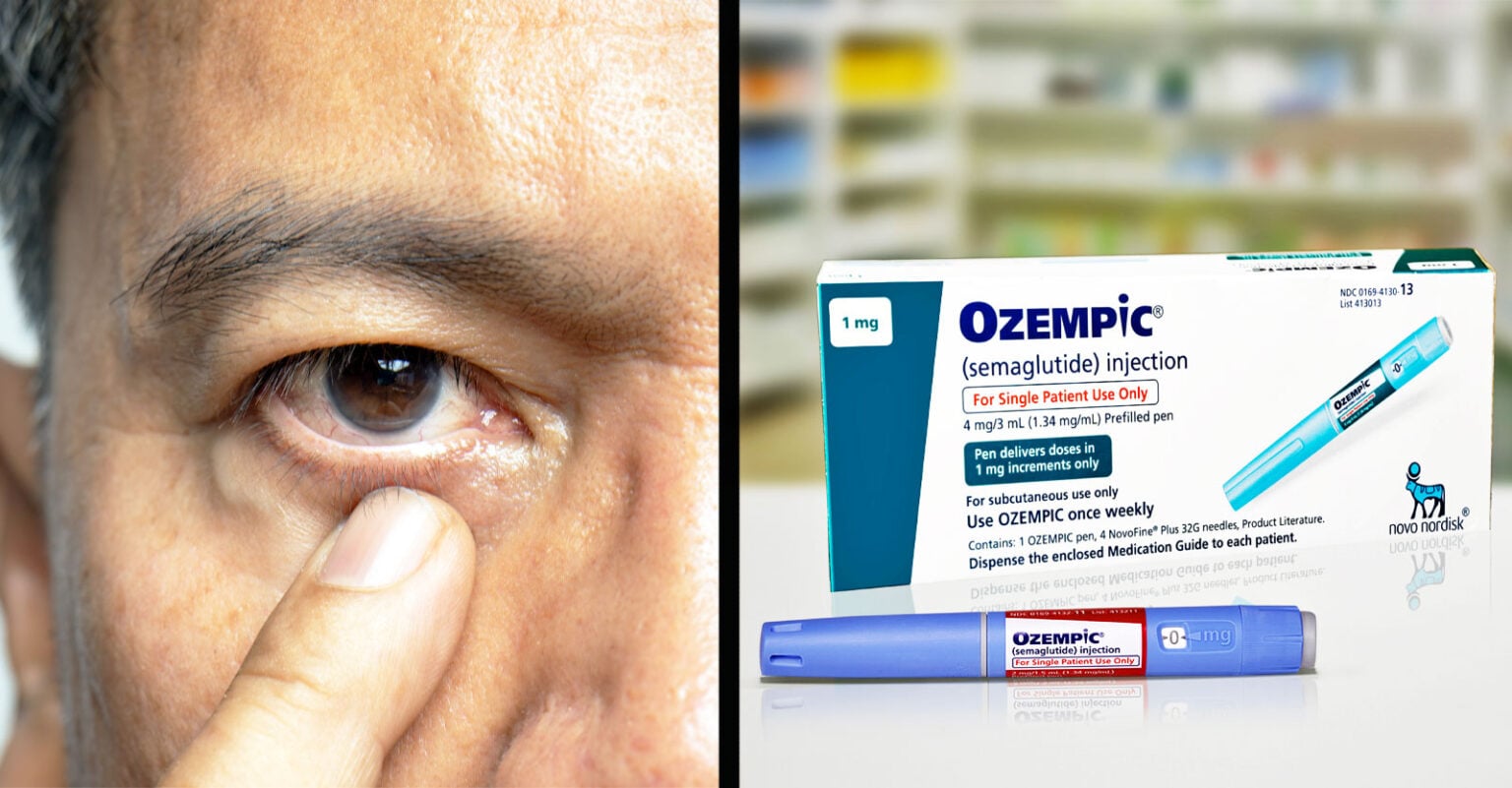 A closer look at Ozempic Side Effects