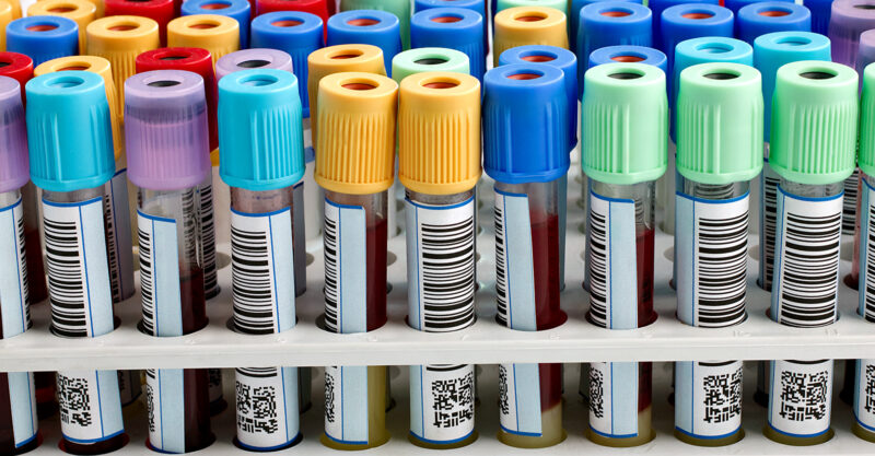 united states pfas exposure testing feature