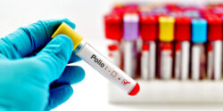 who gates polio outbreak vaccine uk feature