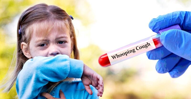 girl coughing and test tube with words "whooping cough"